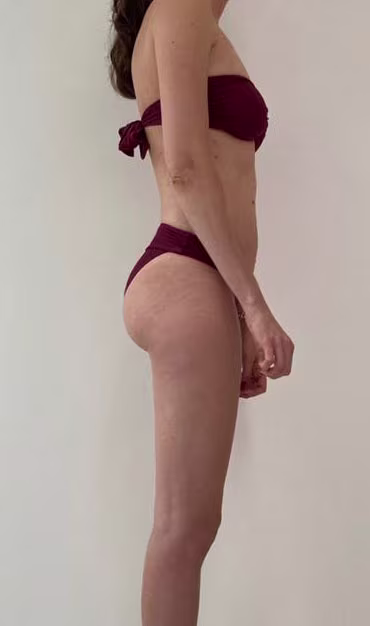 Bum transformation - after picture