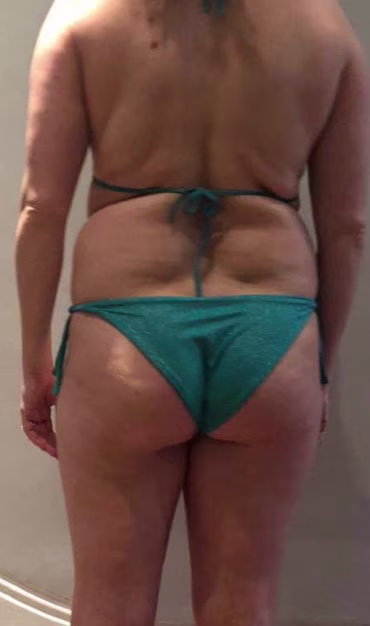 Body transformation - before picture